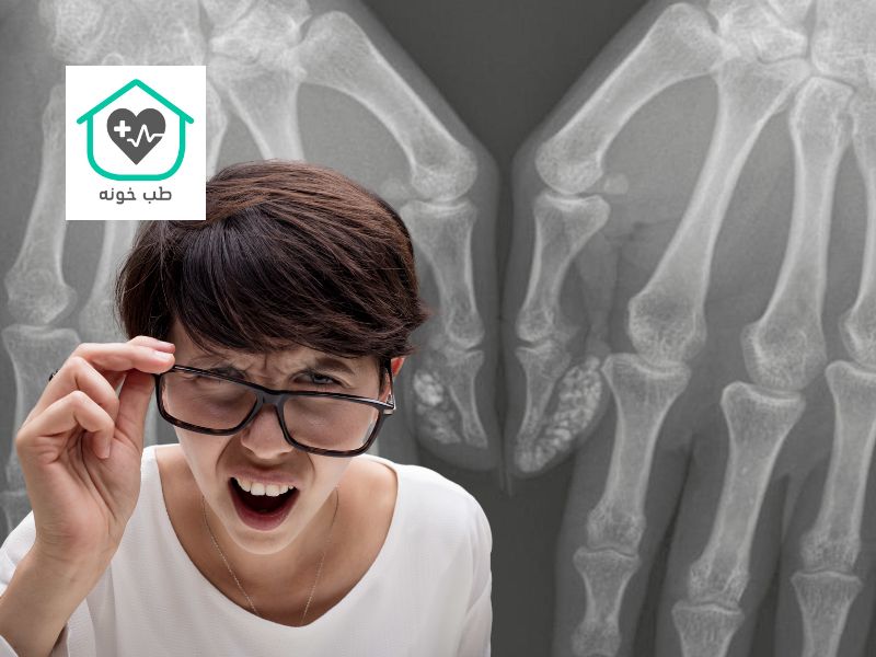 کلسیفیکاسیون چیست