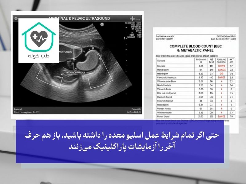 آزمایشات ضروری اسلیو معده