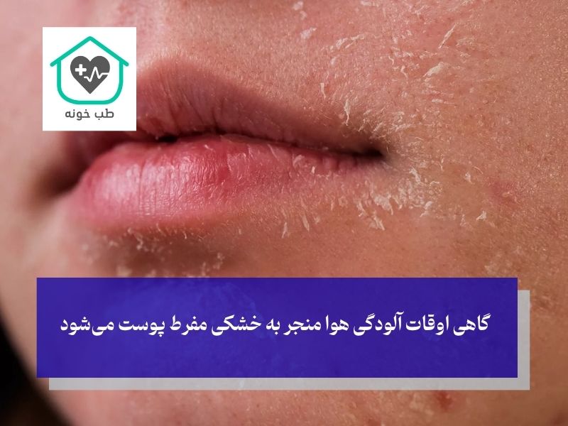 آلودگی هوا و خشکی مزمن