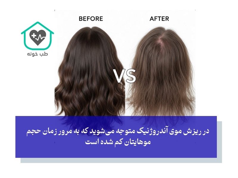 آیا من دچار ریزش موی ارثی هستم