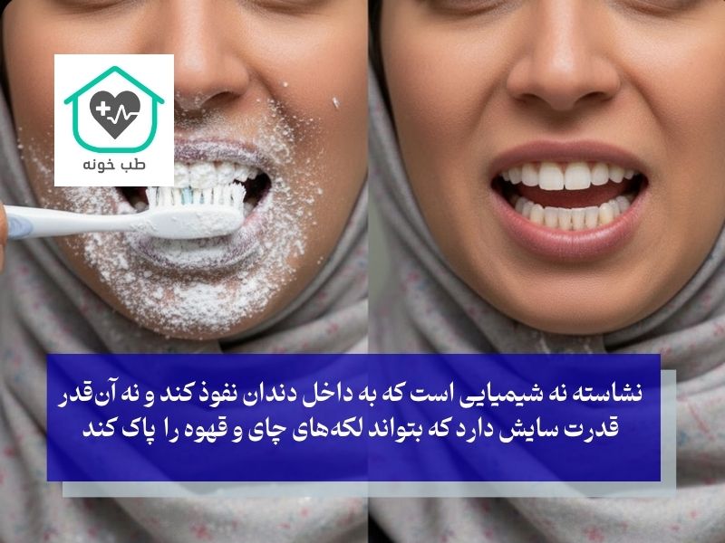 آیا نشاسته اصلا می‌تواند دندان را سفید کند