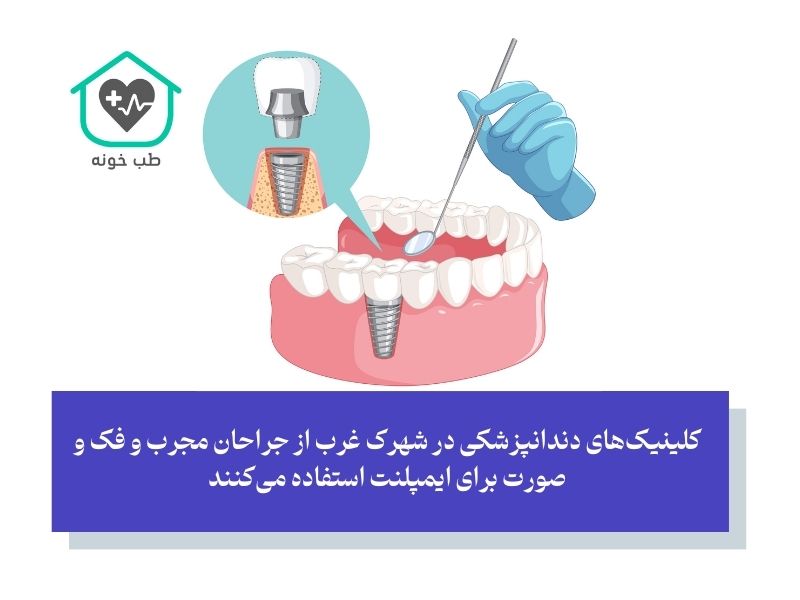 ایمپلنت در شهرک غرب