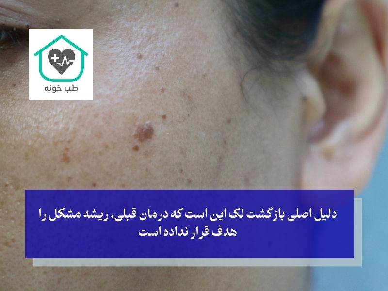 بازگشت لک چرا اتفاق می‌افتد