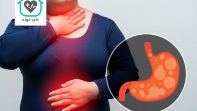 برای ترش کردن معده چی خوبه