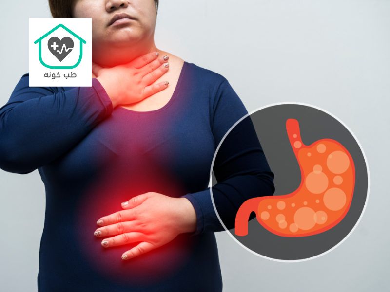 برای ترش کردن معده چی خوبه