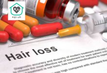 بهترین قرص ضد ریزش مو برای زنان