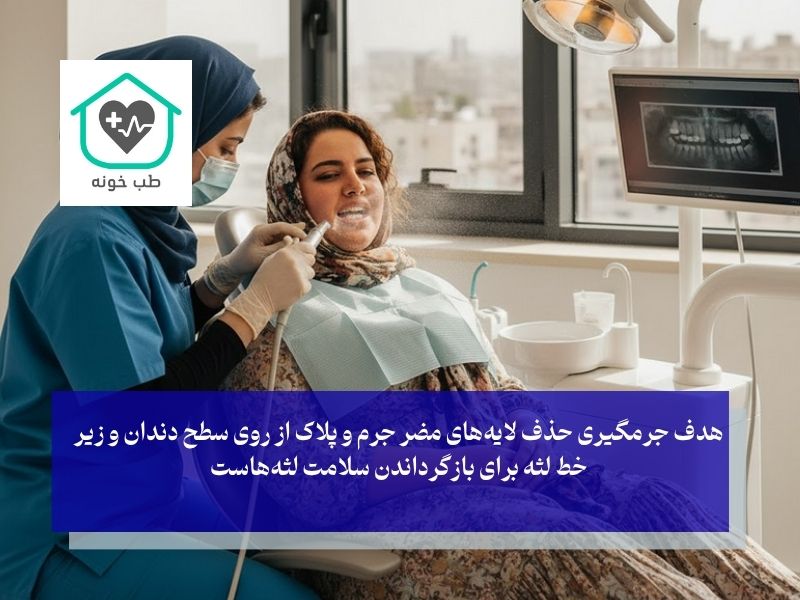 جرم‌گیری حرفه‌ای؛ تنها راه حل قطعی برای درمان جرم دندان