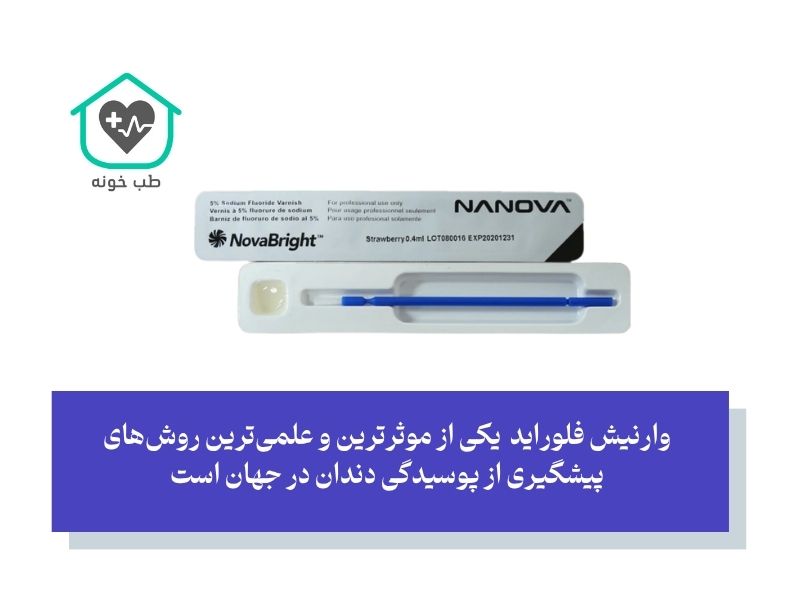 خواص وارنیش فلوراید