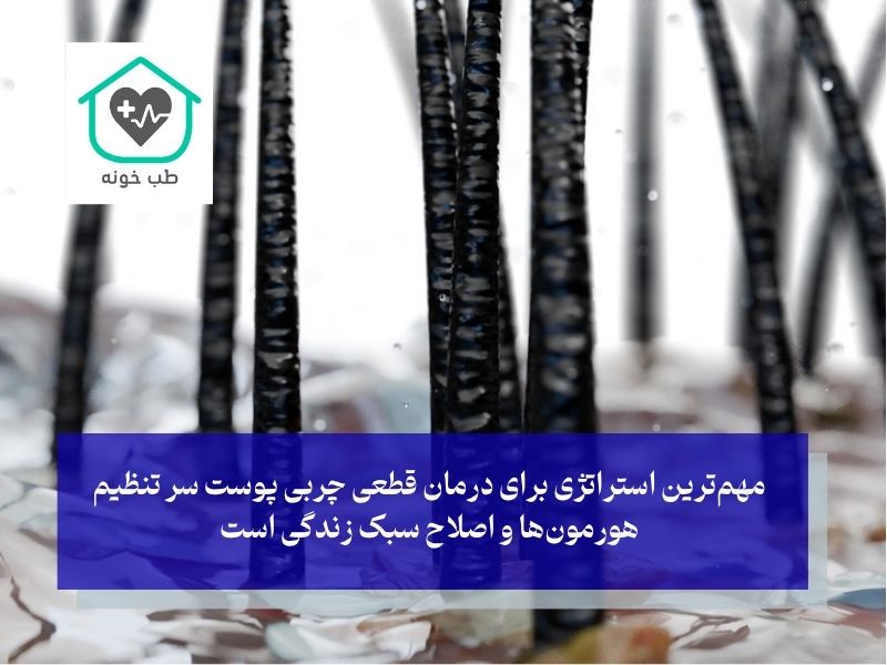 راز رفع دائمی چربی پوست سر چیست