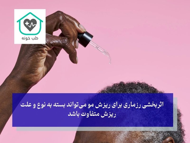 رزماری برای ریزش مو ارثی