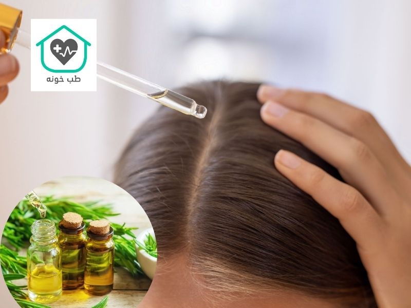 رزماری برای ریزش مو