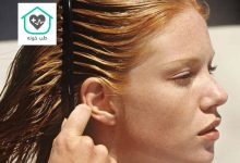 رفع چربی پوست سر