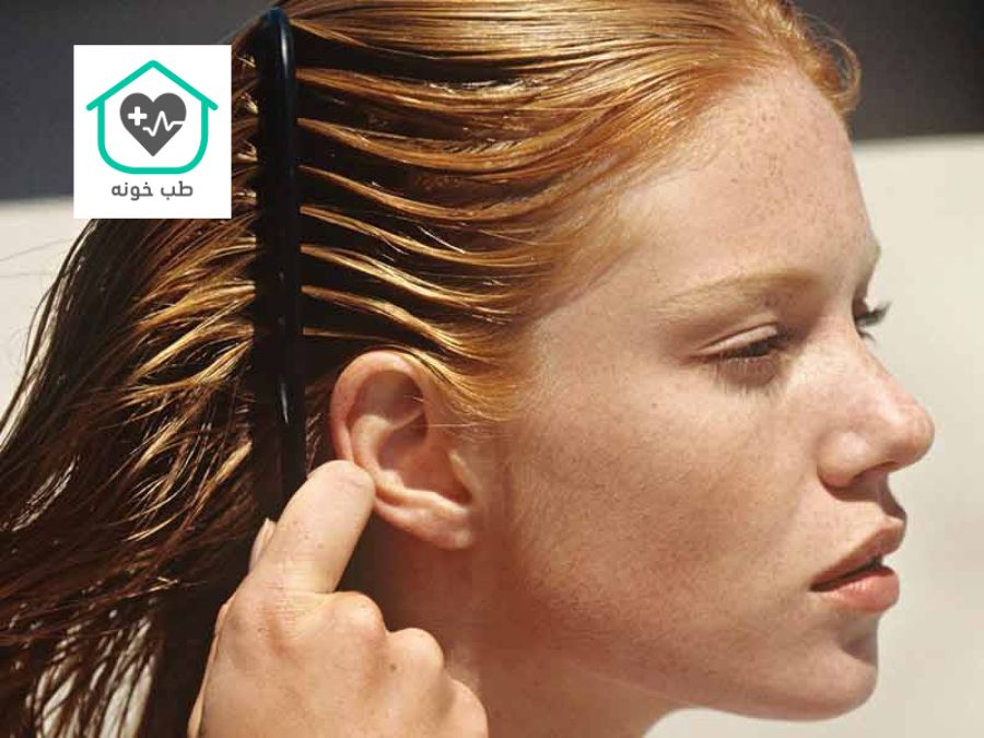 رفع چربی پوست سر