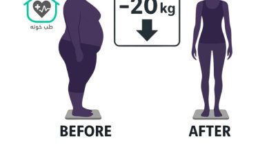 رژيم لاغري ٢٠ كيلو