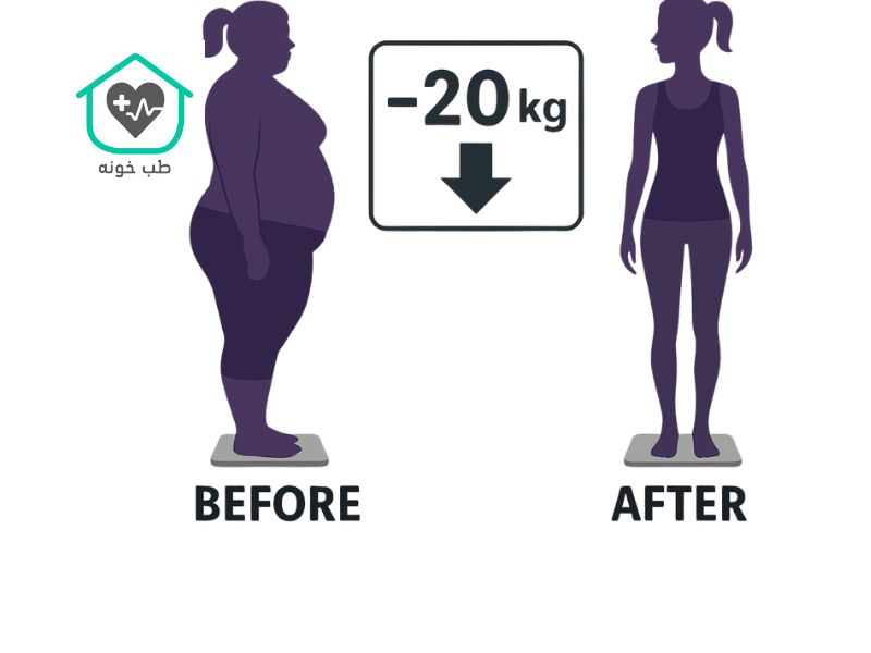 رژيم لاغري ٢٠ كيلو