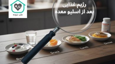 رژیم غذایی بعد از اسلیو معده