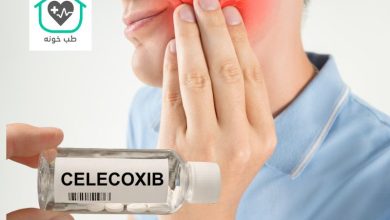 سلکوکسیب برای دندان درد