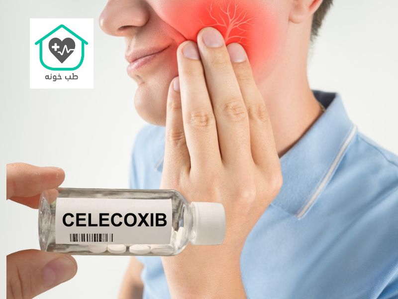 سلکوکسیب برای دندان درد