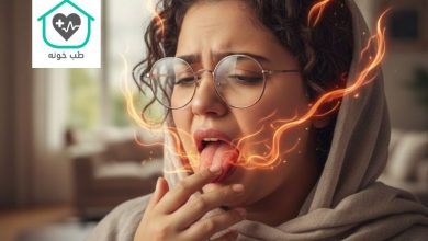 سندروم سوزش دهان
