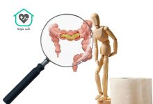 شکل مدفوع در سندروم روده تحریک پذیر