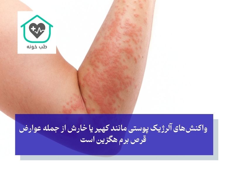 عوارض قرص برم هگزین