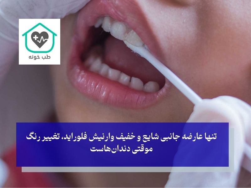 عوارض وارنیش فلوراید