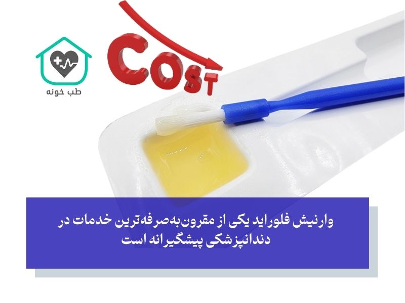 قیمت وارنیش فلوراید