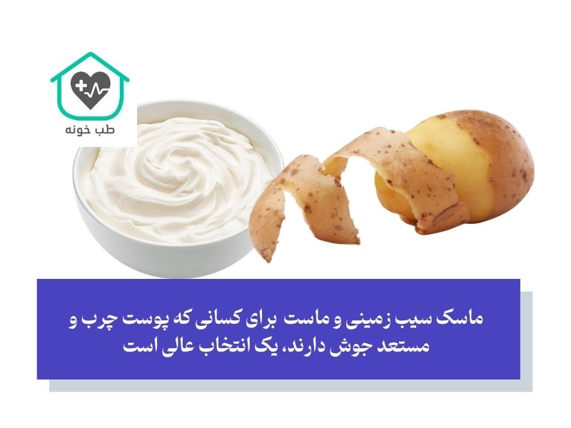 ماسک سیب زمینی و ماست؛ روشن‌کننده و مناسب پوست چرب