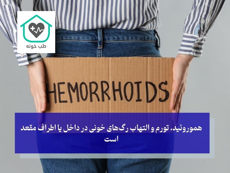 معنی بواسیر چیست؟