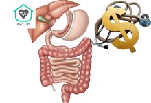 هزینه عمل اسلیو معده