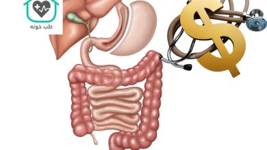 هزینه عمل اسلیو معده