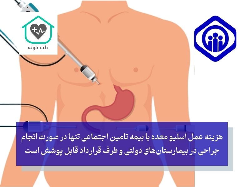 هزینه عمل اسلیو معده با بیمه تامین اجتماعی