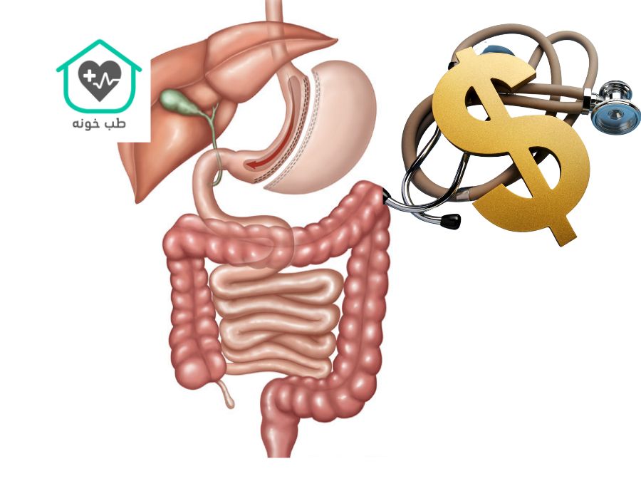 هزینه عمل اسلیو معده