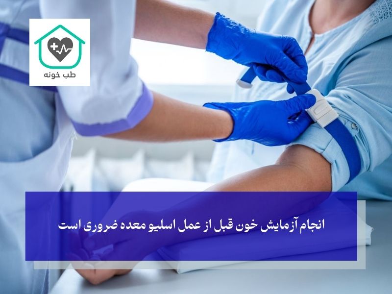 هزینه‌های جانبی عمل اسلیو معده