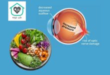 چه غذاهایی فشار چشم را بالا میبرد