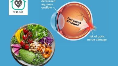 چه غذاهایی فشار چشم را بالا میبرد