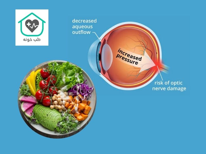 چه غذاهایی فشار چشم را بالا میبرد