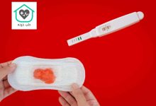 چه مقدار خونریزی در بارداری طبیعی است