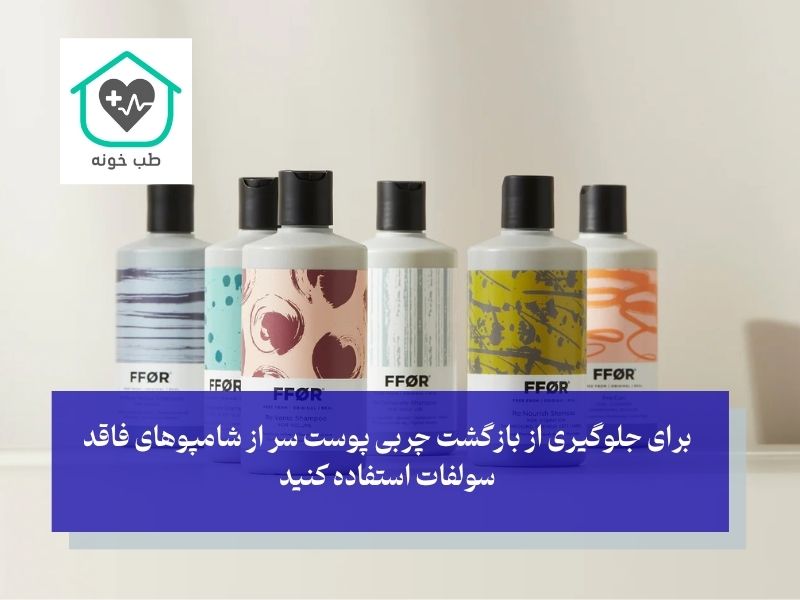 چگونه از بازگشت چربی پوست سر پیشگیری کنیم؟