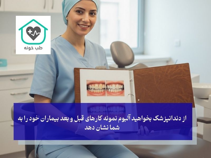 چگونه بهترین دندانپزشک زیبایی در غرب تهران را برای خودمان پیدا کنیم