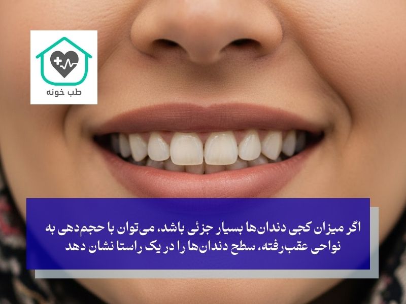 آیا دندان‌های کج را می‌توان بدون تراش اصلاح کرد