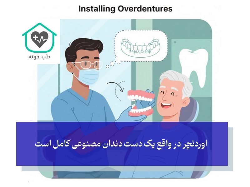 اوردنچر متکی بر ایمپلنت