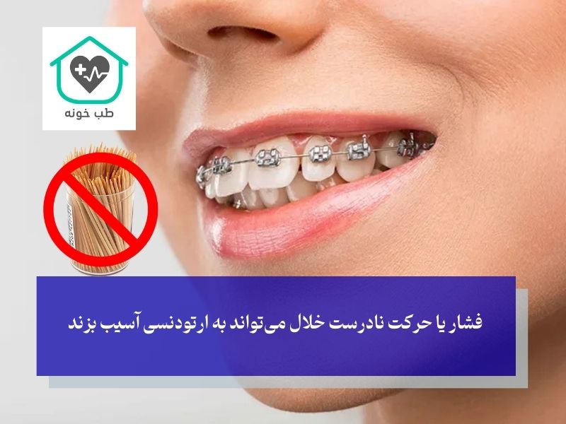 برای چه کسانی استفاده از خلال دندان پیشنهاد نمی‌شود