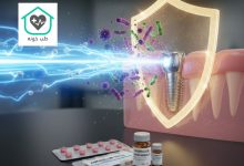 بهترین آنتی بیوتیک برای عفونت ایمپلنت