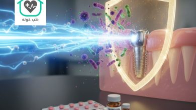 بهترین آنتی بیوتیک برای عفونت ایمپلنت