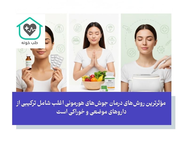 بهترین روش‌های درمان جوش های هورمونی