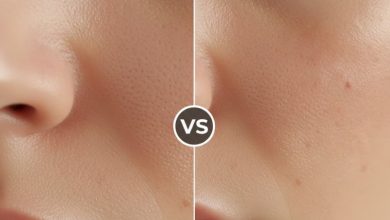 بهترین کرم برای منافذ باز پوست