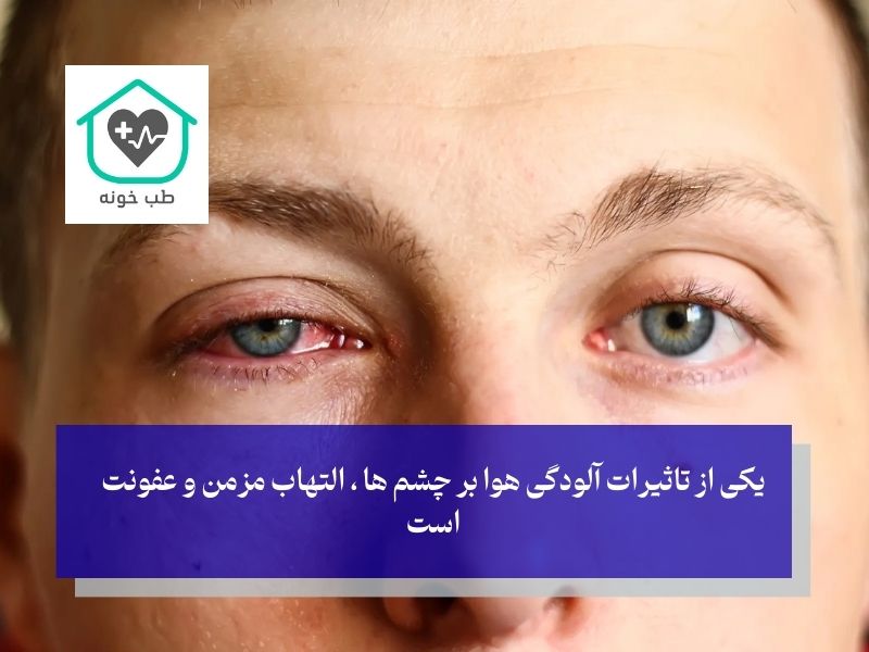 تاثیر آلودگی هوا بر چشم ها و التهاب مزمن