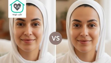 تزریق پروفایلو