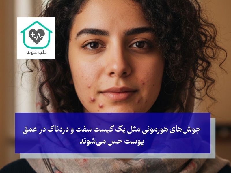 جوش‌های هورمونی چه شکلی هستند